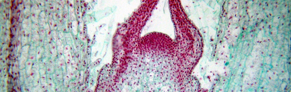 median longitudinal section through a Coleus stem tip